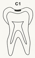 C1