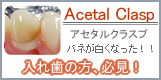 Acetal Clasp
